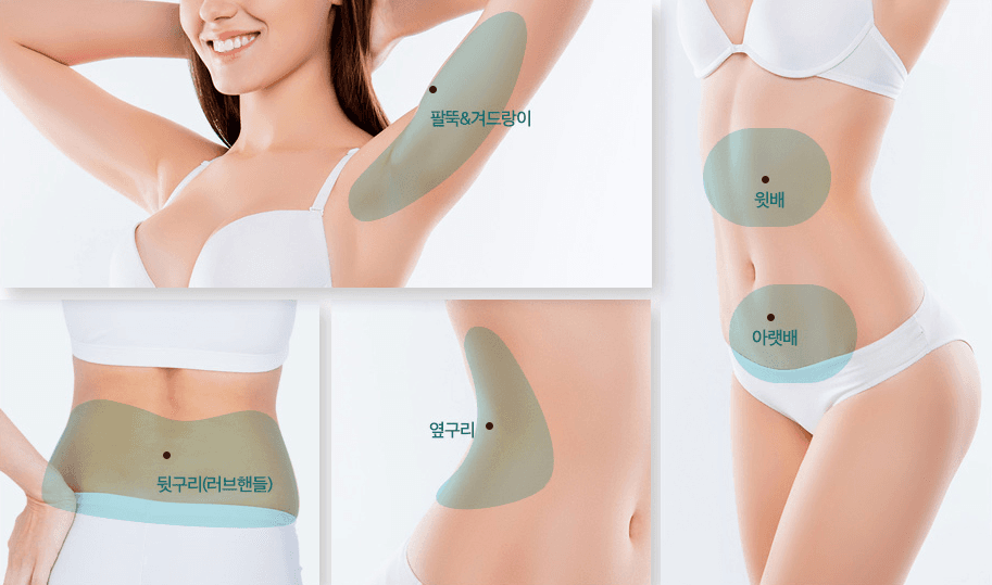 복부 팔뚝 옆구리 부분라인 관리 부위