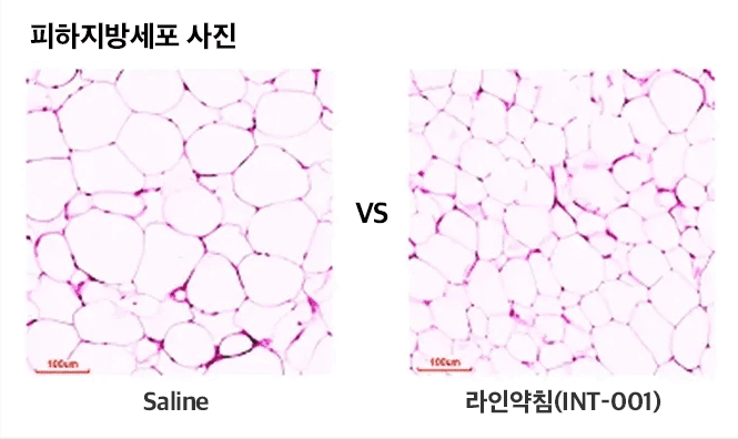 피하지방세포 비교 연구자료