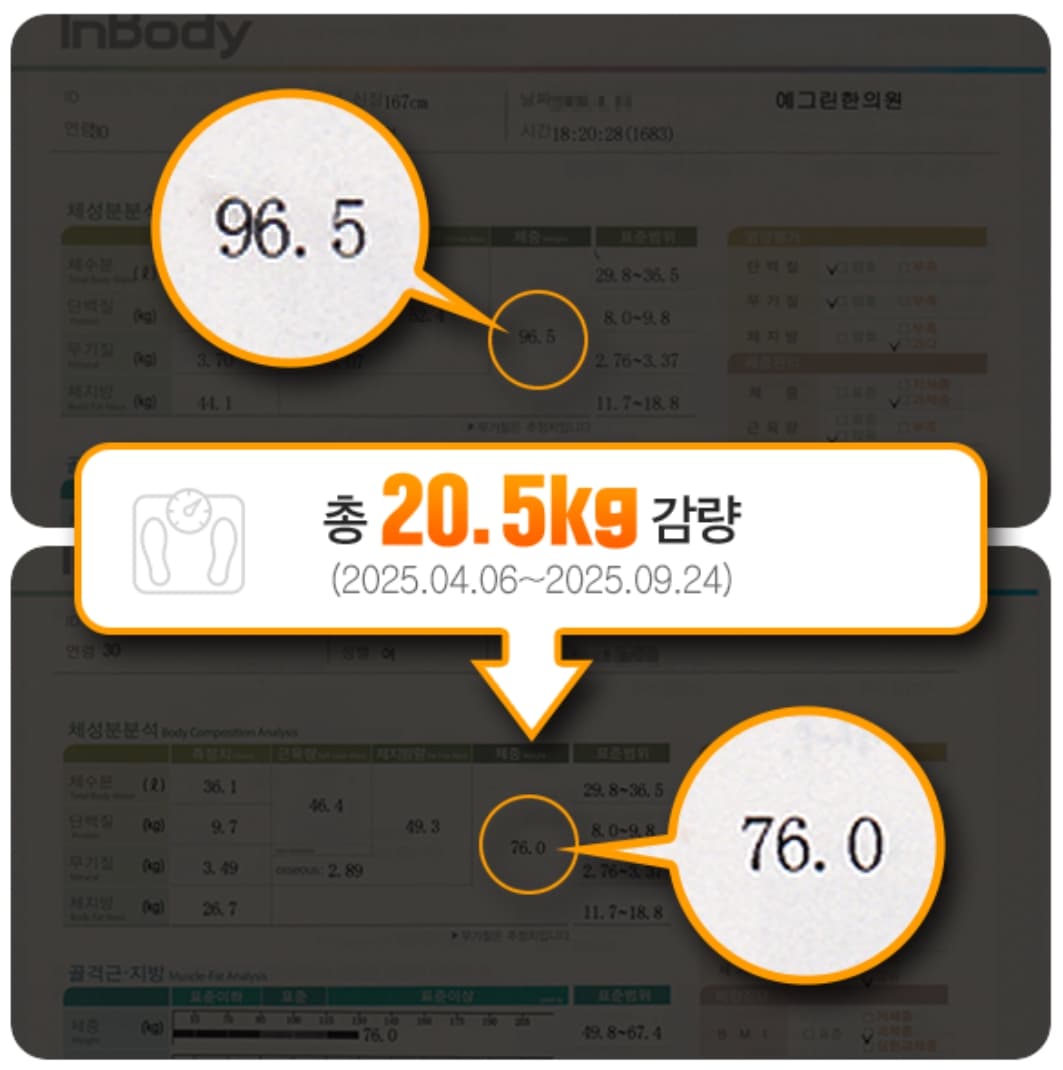 96.5kg에서 76.0kg으로 감량한 실제 체성분 검사 사례