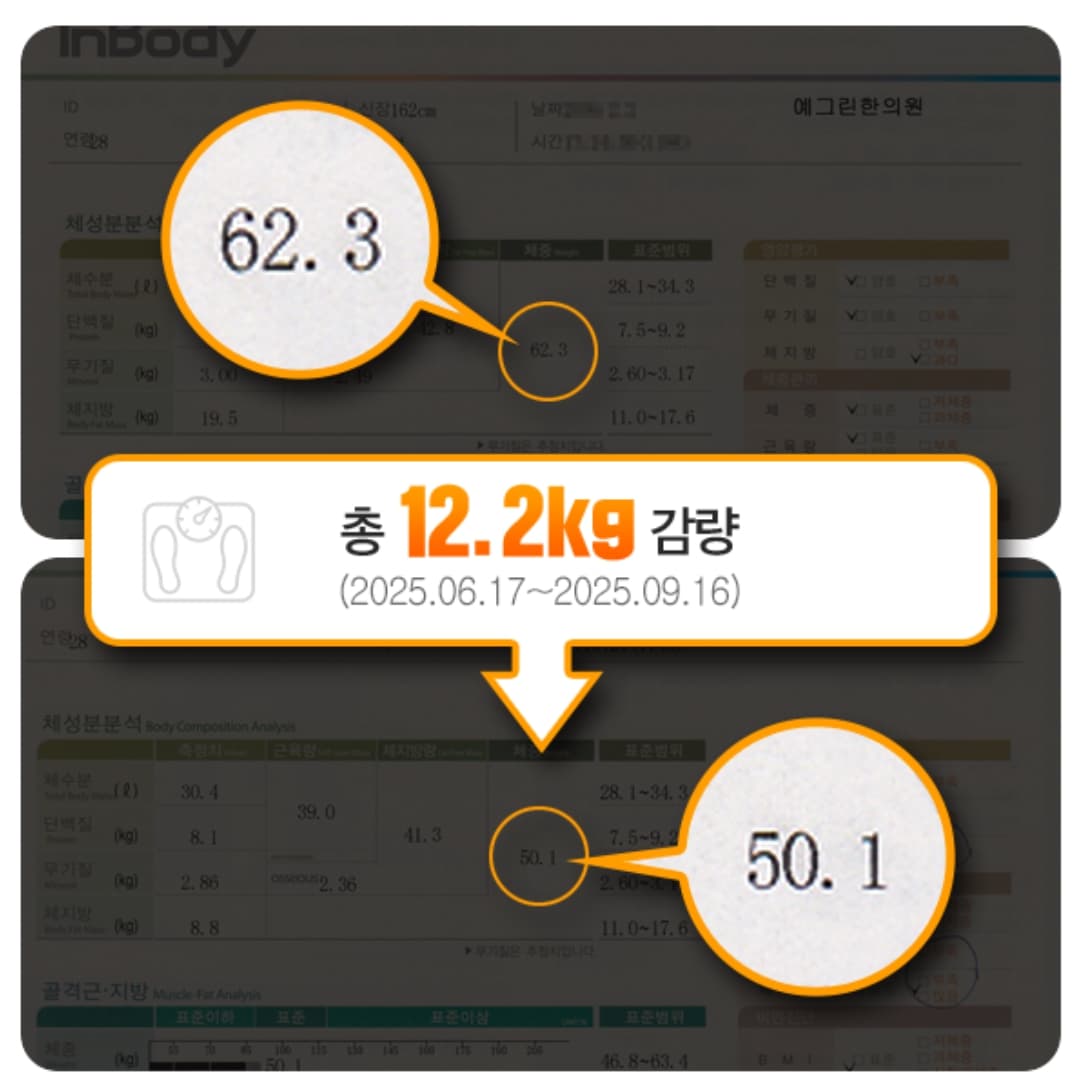 62.3kg에서 50.1kg으로 감량한 실제 체성분 검사 사례