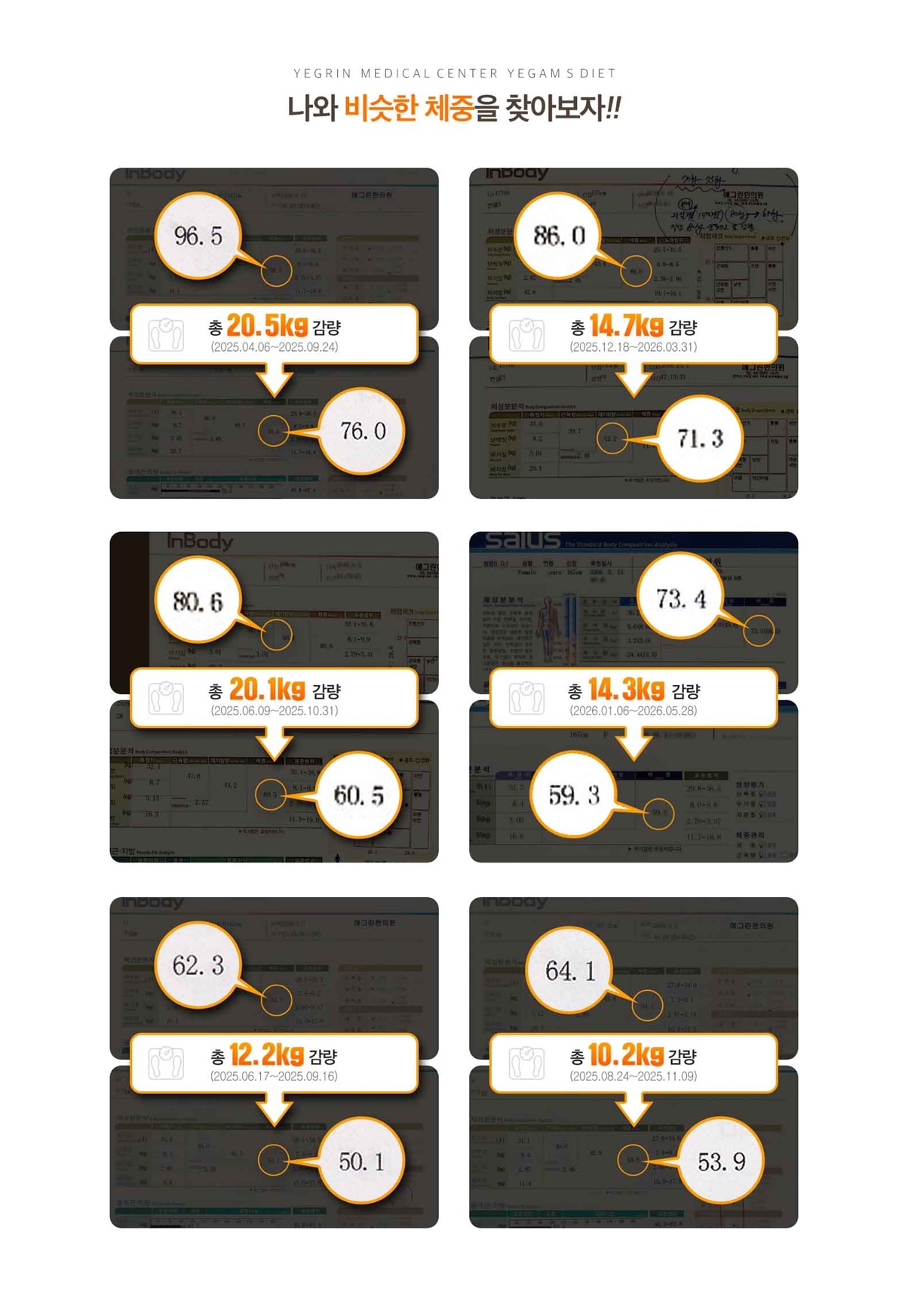 더예그린한의원 다이어트 전후 변화 사례